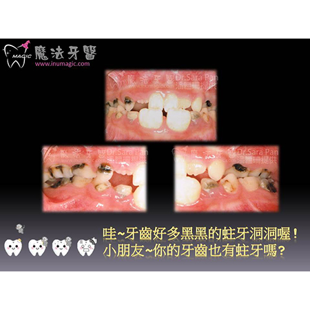 儿童矫正牙齿 - Children Dental-1 儿童矫正牙齿 - Children Dental-1