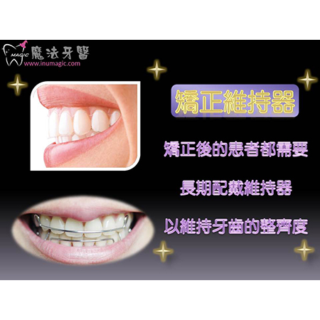 维持器 - Dental Orthodontic-13 维持器 - Dental Orthodontic-13