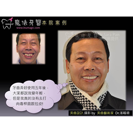 牙周病治疗 - Periodontal Disease Treatment-5 牙周病治疗 - Periodontal Disease Treatment-5