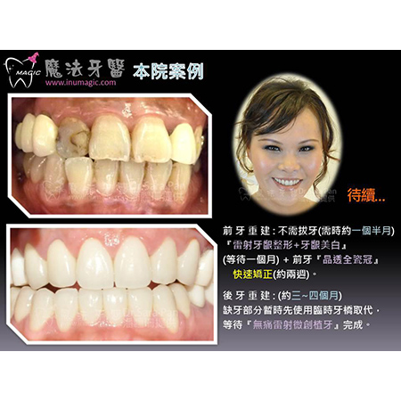微笑曲线 - Dental Esthetics-4 微笑曲线 - Dental Esthetics-4