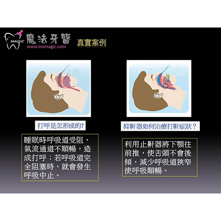 打呼 - Good Dentist-11 打呼 - Good Dentist-11
