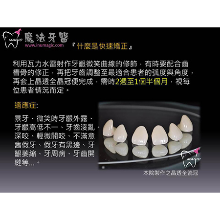 快速矫正 - Dental Orthodontic-1 快速矫正 - Dental Orthodontic-1
