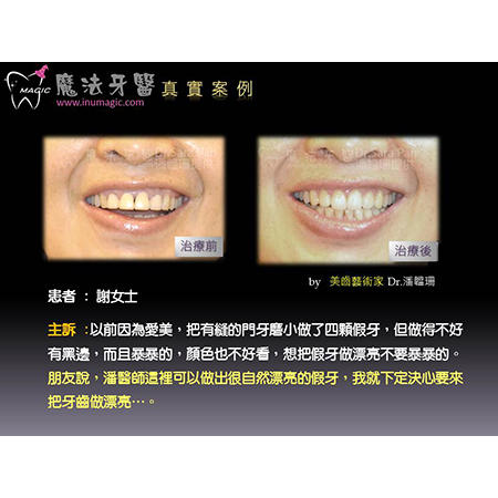 牙科中心 - Dental Implants-2 牙科中心 - Dental Implants-2