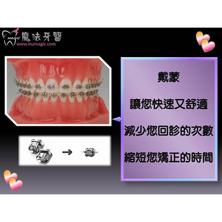 戴蒙矫正器 - Dental Orthodontic-12 戴蒙矫正器 - Dental Orthodontic-12
