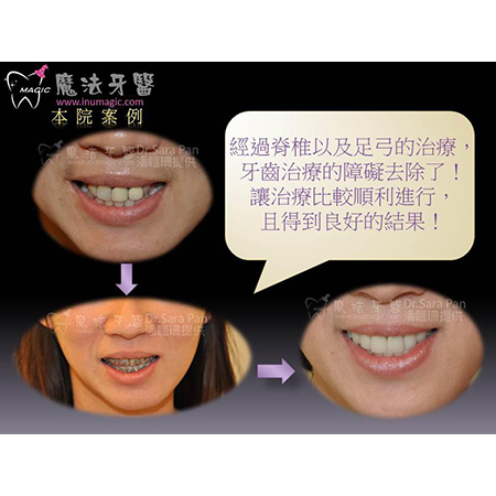 脊椎侧弯 - Dental Orthodontic-9 脊椎侧弯 - Dental Orthodontic-9