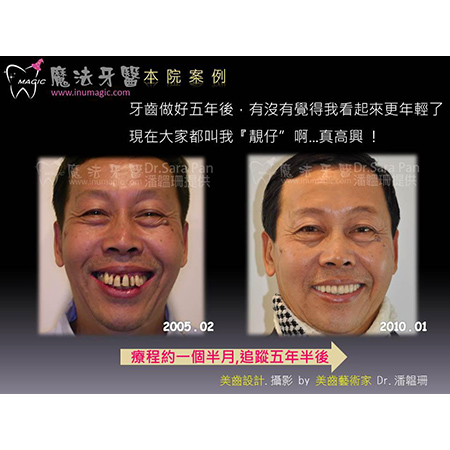 植牙医师 - Good Dentist-5 植牙医师 - Good Dentist-5