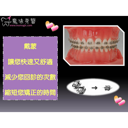 矫正 - Dental Orthodontic-6 矫正 - Dental Orthodontic-6